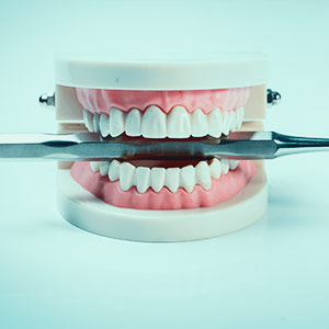 3D-Printing-Dentistry