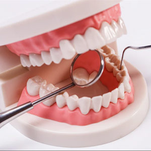 Advanced Gum Treatment