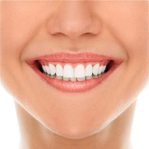 Tooth Whitening