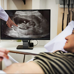 USG / ECHO Color Doppler